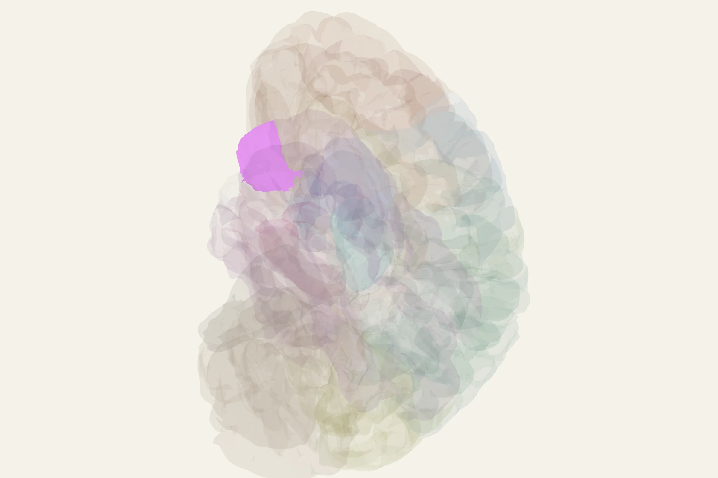 Left Anterior Temporal Lobe highlighted in colour on a rotatable 3D model of the human brain