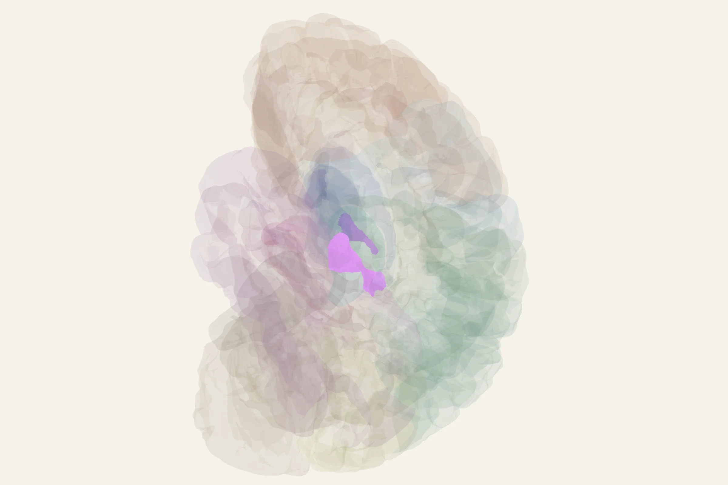 Auditory Cortex highlighted in colour on a rotatable 3D model of the human brain