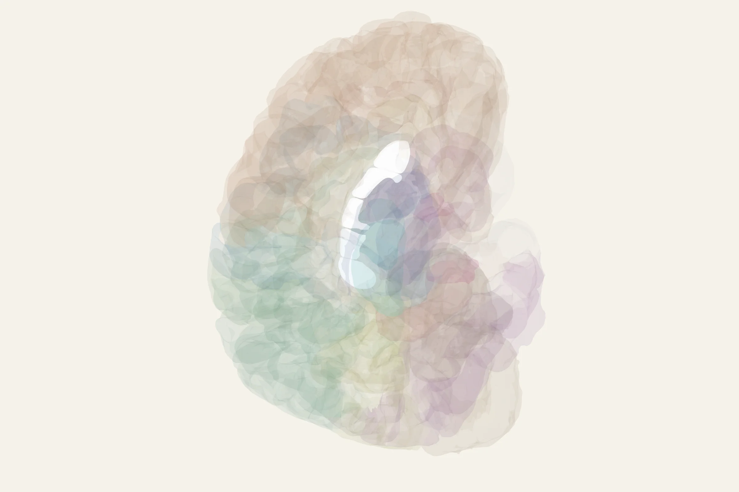 Corpus Callosum highlighted in colour on a rotatable 3D model of the human brain