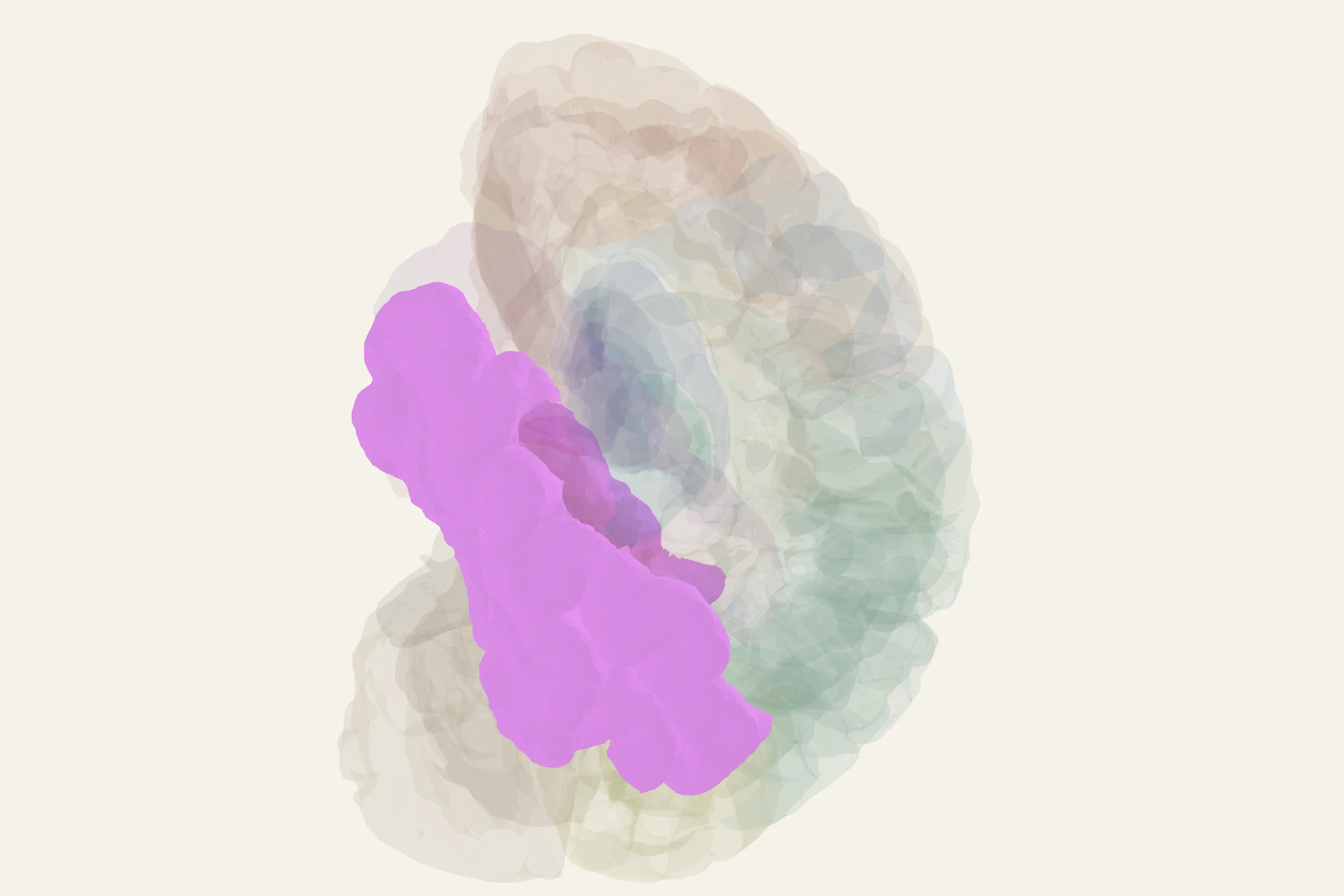 Temporal Cortex highlighted in colour on a rotatable 3D model of the human brain