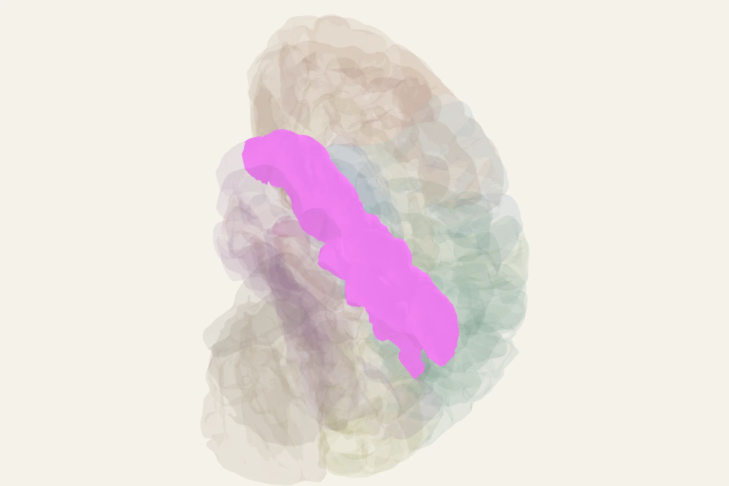 Wernicke's Area highlighted in colour on a rotatable 3D model of the human brain
